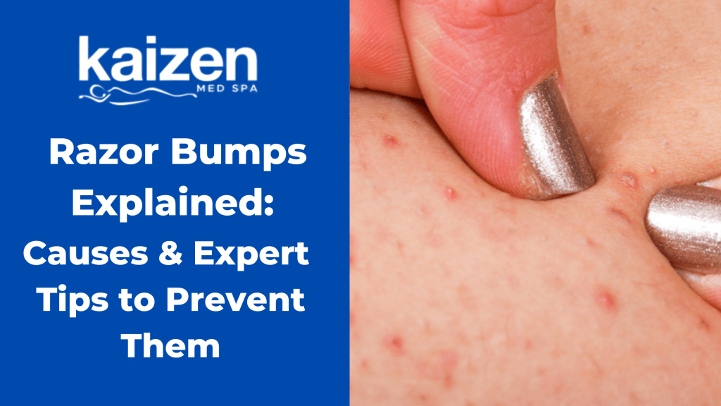 Inkey Razor Bump Razor Bumps: Causes & Expert Tips to Prevent Them