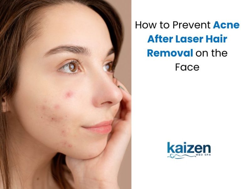 How to Prevent Acne After Laser Hair Removal on the Face